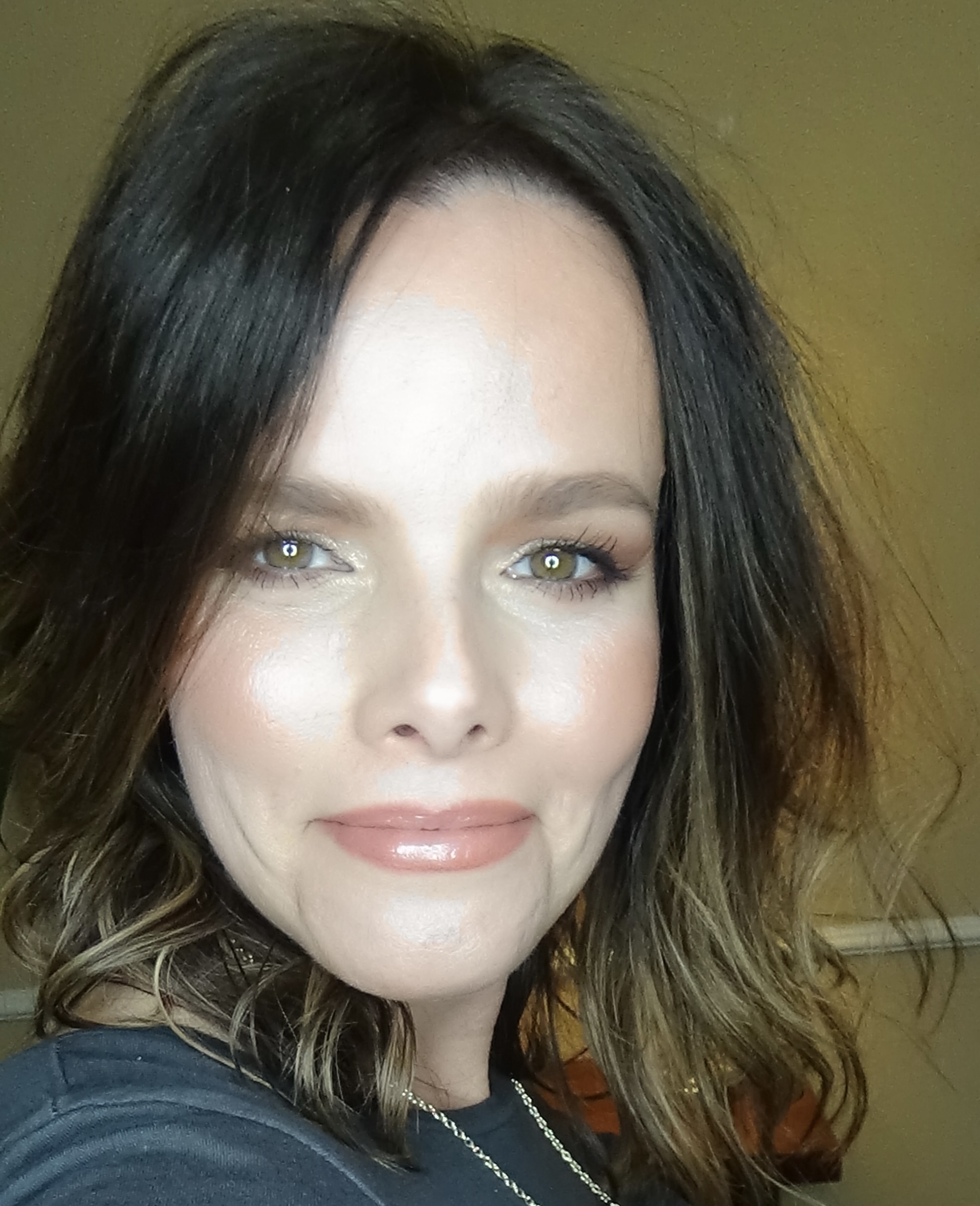 Lilac Botbol, MSN, ARNP, FNP-BC